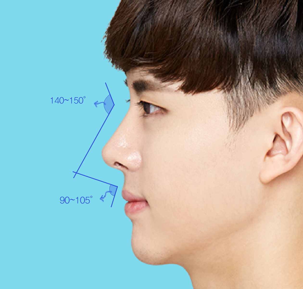 鼻综合案例对比，塌鼻子男生做完隆鼻收获一大堆迷妹 _圈子-新氧美容整形